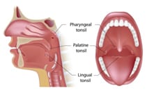 SleepFacts_EckCreativeMedia_Large_Tonsils