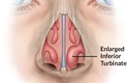 SleepFacts_EckCreativeMedia_Breathing’s Important_Nose