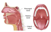 SleepFacts_EckCreativeMedia_Large_Tonsils