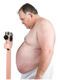 SleepFacts_EckCreativeMedia_OSA_Obese_Male