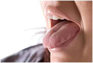 SleepFacts_EckCreativeMedia_Signs_of_Sleep_Disordered_Breathing_Tongue