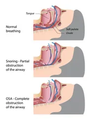 SleepFacts_EckCreativeMedia_Design_The_Big_3